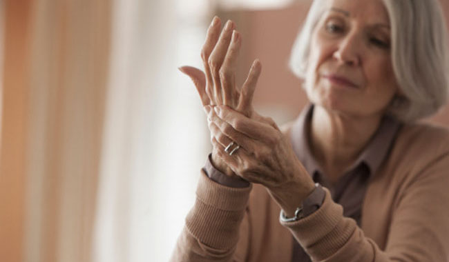 Exercise for Arthritis 