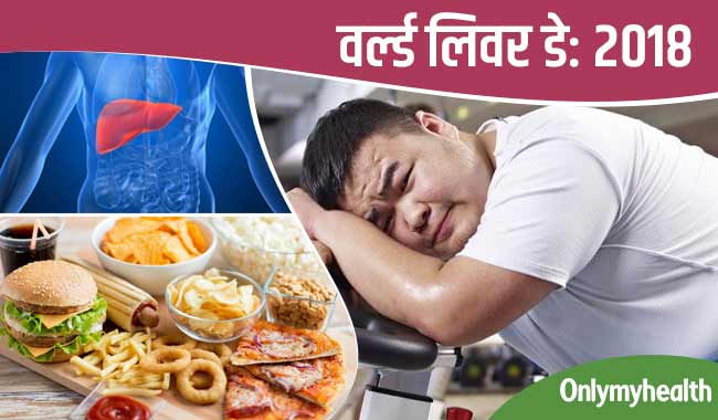 वर्ल्ड लिवर डे : गलत डाइट और एक्सरसाइज के अभाव में खराब करता है लिवर