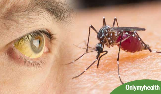 Why Does Malaria Cause Jaundice