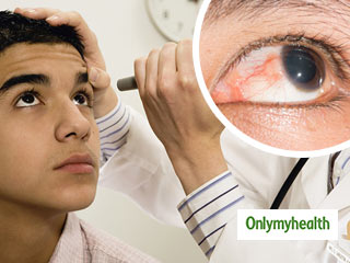 खतरनाक हो सकती है आंखों के पर्दे की सूजन, जानें क्या हैं लक्षण और उपचार