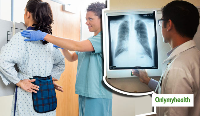 Know The Process Of Chest X Ray Test And When Is It Needed In Hindi