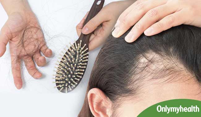 Ayurvedic Treatment for Hair Loss