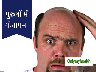 जानें क्यों सिर्फ पुरुषों में होती है गंजेपन की समस्या, कौन से हार्मोन हैं जिम्मेदार