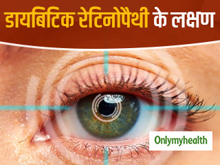 शुरुआत में ऐसे लक्षण दिखाती है डायबिटिक रेटिनोपैथी, जानें बचाव के आसान तरीके