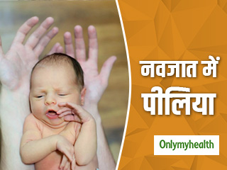 नवजात बच्चों को पीलिया होने पर इलाज के साथ दें ये नैचुरल थेरेपी, जल्दी होगा ठीक