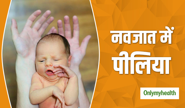नवजात बच्चों को पीलिया होने पर इलाज के साथ दें ये नैचुरल थेरेपी, जल्दी होगा ठीक