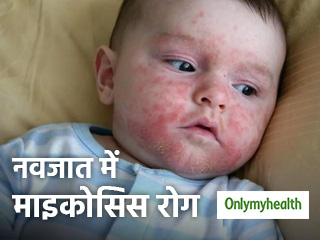 सर्दियों में आम है नवजात को माइकोसिस रोग होना, तुरंत जानें इसके शुरुआती लक्षण