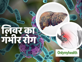लिवर को खराब कर सकता है हेपेटाइटिस रोग, जानें कैसे कर सकते हैं बचाव और इलाज