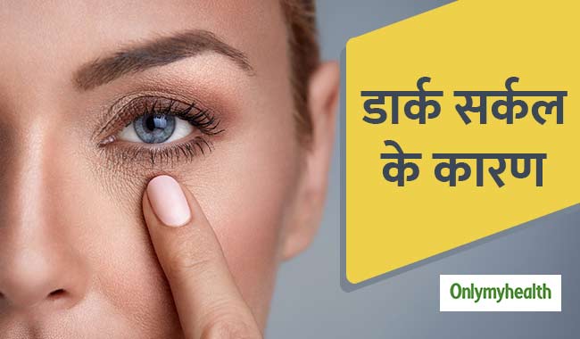 शरीर में इन 5 तत्वों की कमी से होते हैं डार्क सर्कल्स, ये हैं इन्हें दूर करने के उपाय