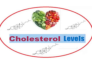 Signs You May Have High Cholesterol or Hypercholesterolemia