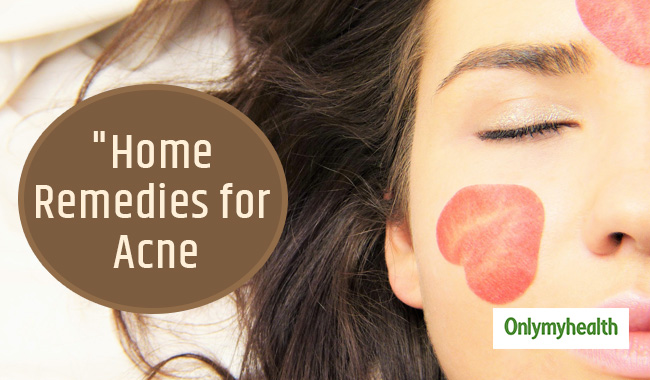 Looking for Natural Cure for Acne Problem? Try these Effective Home Remedies 