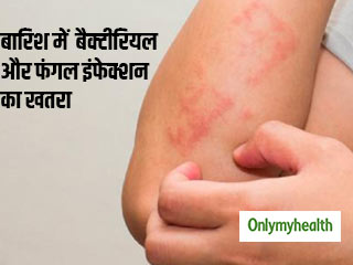 बारिश में बढ़ जाता है बैक्टीरियल और फंगल इंफेक्शन का खतरा, ऐसे करें बचाव