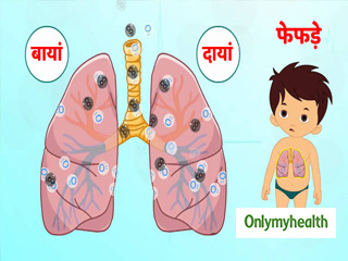 बच्‍चों के फेफड़ों में संक्रमण के संकेत हैं ये 5 लक्षण, जानें कारण और उपचार