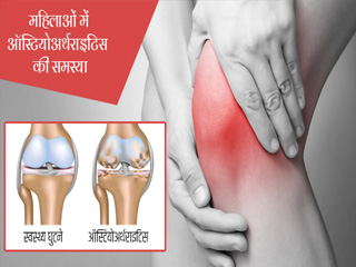 महिलाओं में मेनोपॉज के बाद क्यों बढ़ जाता है ऑस्टियोअर्थराइटिस का खतरा?