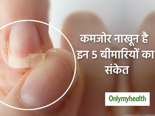 नाखूनों का कमजोर होकर जल्दी टूटना भी है कई बीमारियों का लक्षण