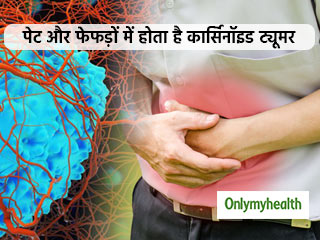 खतरनाक रोग है कार्सिनॉइड ट्यूमर, कैंसर जैसे होते हैं लक्षण