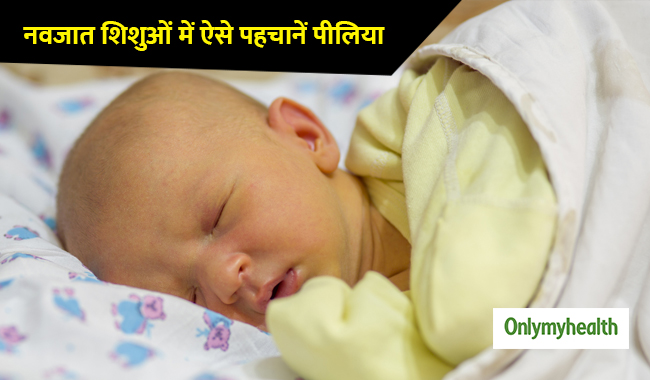 नवजात शिशु में पीलिया के होते हैं ये खास लक्षण, ऐसे पहचानें