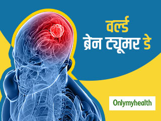 World Brain Tumour Day 2020: ब्रेन ट्यूमर क्‍या है? एक्‍सपर्ट से जानें इसके कारण, लक्षण और उपचार