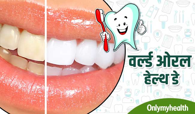 World Oral Health Day: दांतों के रंग बताते हैं सेहत का राज, जानें क्या है आपका हाल