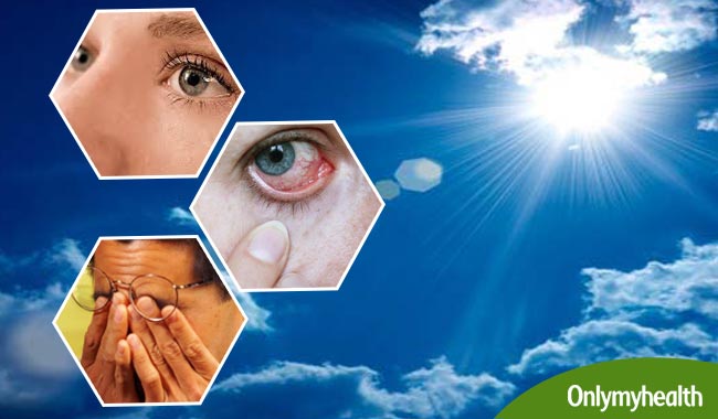 गर्मियों में आंखों के संक्रमण का अचूक इलाज है ये 11 सस्‍ते उपाय