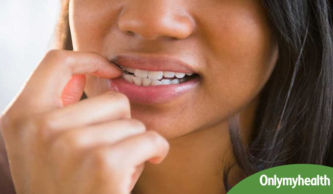 Is Chronic Nail Biting a Bad Habit, OCD, or Something More? - GoodRx