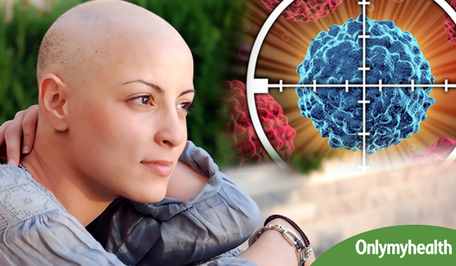 टारगेटेड थैरेपी है कैंसर का बेस्ट इलाज, मगर करवाने से पहले जान लें ये 5 बातें