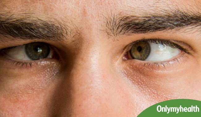 Black Spots That Appear In Front Of The Eyes May Be Dangerous In Hindi 