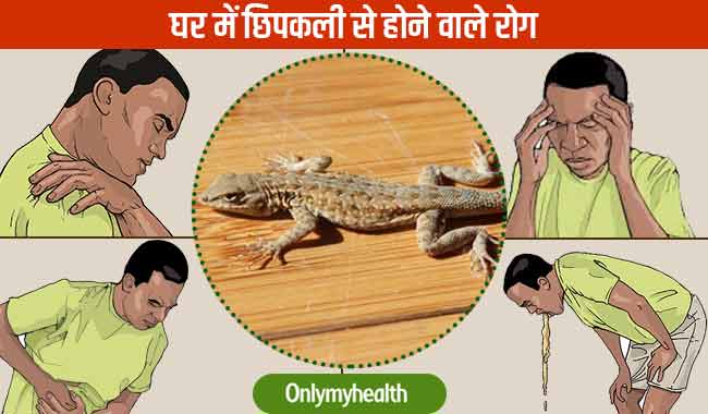 घर में छिपकली से हो सकती हैं ये जानलेवा बीमारियां, इन घरेलू नुस्खों से भगाएं दूर