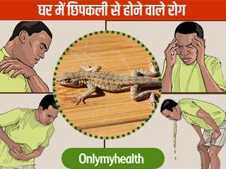 घर में छिपकली से हो सकती हैं ये जानलेवा बीमारियां, इन घरेलू नुस्खों से भगाएं दूर