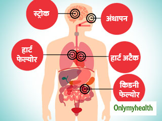 World Hypertension Day: शरीर के कई अंगों पर होता है हाई ब्लड प्रेशर का असर, जानें खतरे