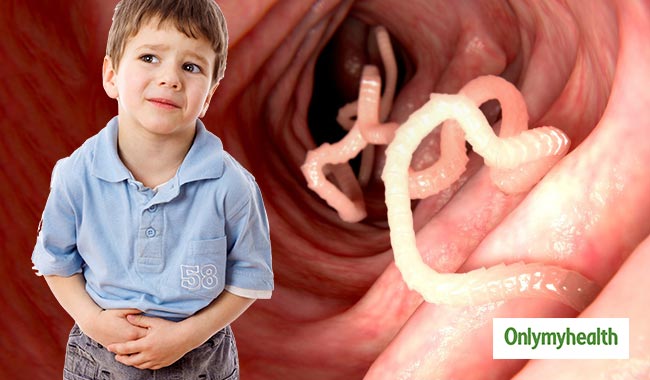 कई प्रकार के होते हैं बच्चों पेट में पाए जाने वाले कीड़े, जानें किन लक्षणों से पहचानें इन्हें