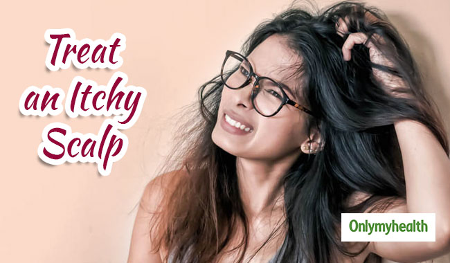 Kitchen Ingredients to Get Rid of an Itchy Scalp