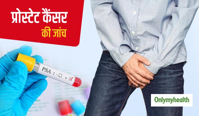 पुरुषों को प्रोस्टेट कैंसर से बचाव के लिए जरूर करवाना चाहिए 'पीसीए' टेस्ट