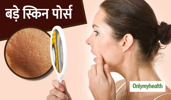त्वचा के पोर्स क्यों हो जाते हैं बड़े और कैसे करें इनकी सफाई?