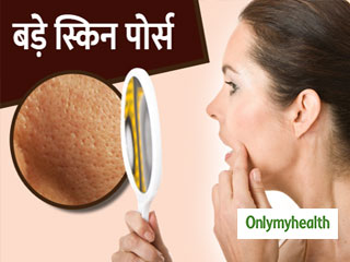 त्वचा के पोर्स क्यों हो जाते हैं बड़े और कैसे करें इनकी सफाई?