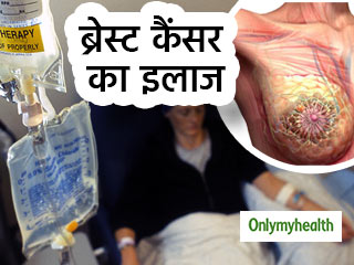 ये 5 तरीके हैं ब्रेस्ट कैंसर के 'स्टैंडर्ड ट्रीटमेंट', जानें कैसे किया जाता है इलाज