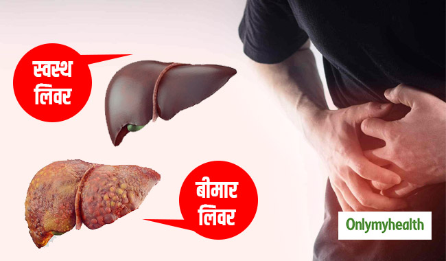 लिवर के लिए खतरनाक हैं ये 7 चीजें, हमेशा रहें दूर