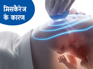 क्यों होता है महिलाओं का मिसकैरेज? जानें इसके मुख्य कारण और बचाव के तरीके