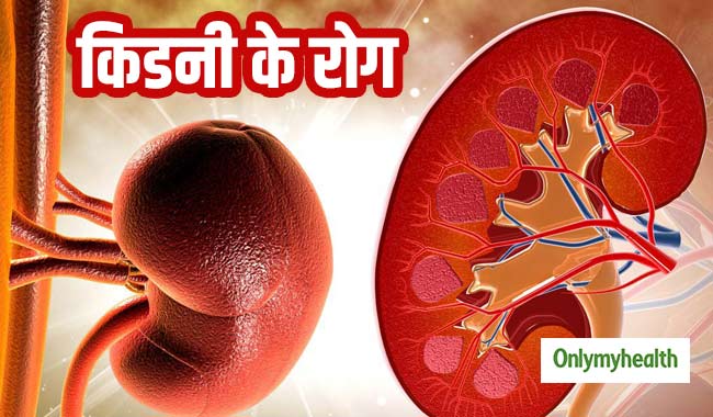 आखिर क्यों होती हैं किडनी की बीमारियां और कैसे काम करती है आपकी किडनी?