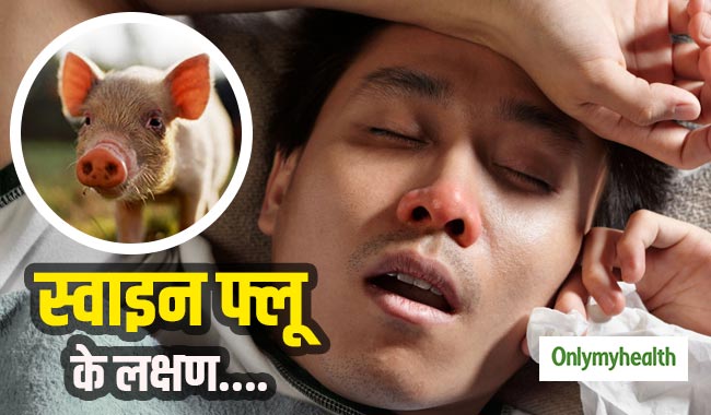 देशभर में स्वाइन फ्लू से 542 मौतें, बुखार, उल्टी और दस्त हैं इसके मुख्य लक्षण