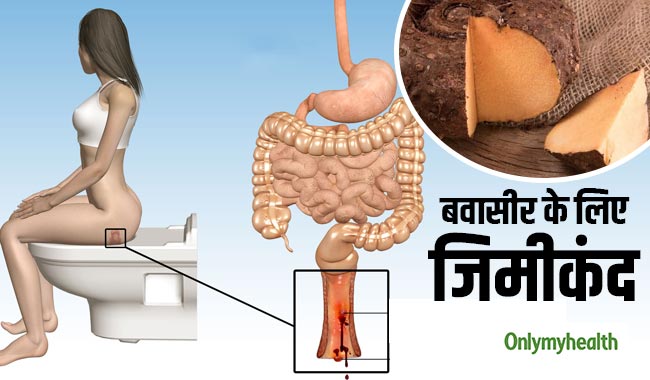 पुरानी से पुरानी बवासीर को सही करता है जिमीकंद, जानिए इसके लाजवाब फायदे