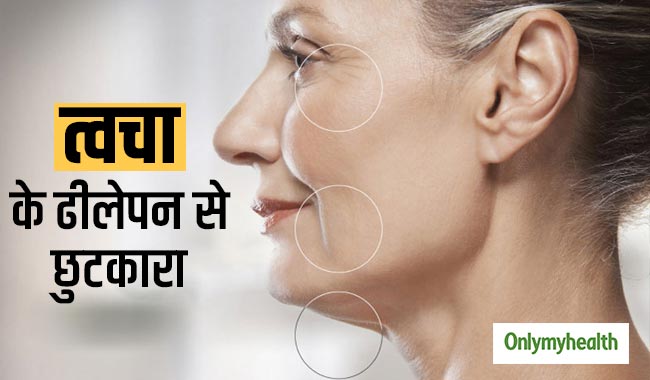 दवाएं नहीं, ढीली त्वचा में नैचुरल तरीके से कसाव लाना है, तो अपनाएं ये 6 टिप्स