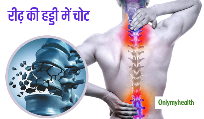 Spinal Cord Injury Day: जानें क्यों खतरनाक है रीढ़ की हड्डी की चोट? कैसे करें इससे बचाव