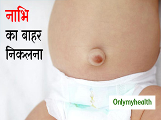शिशुओं में नाभि का बाहर निकलना हो सकता है अम्बिलिकल हर्निया, जानें कारण