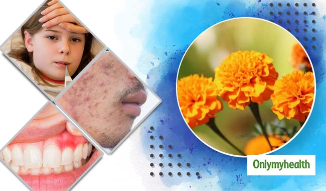 मुंहासों, बुखार और मसूड़े के रोगों में फायदेमंद है गेंदे का फूल, ऐसे करें प्रयोग
