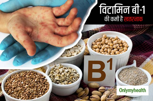 Vitamin B 1 Or Thiamine Deficiency Can Cause Beriberi Know The Symptoms In Hindi