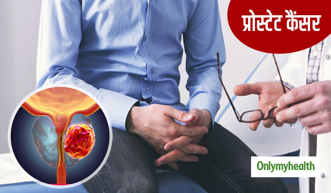 दिल्ली में दूसरा सबसे बड़ा रोग बना प्रोस्टेट कैंसर, पुरुष इन लक्षणों से करें पहचान