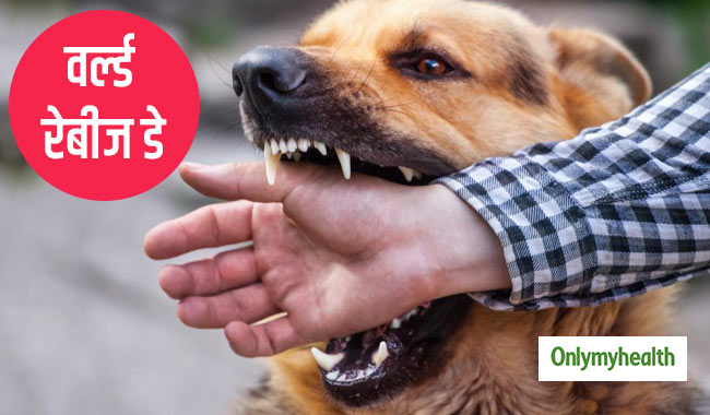 World Rabies Day 2019: जानवरों के काटने से क्यों होता है रेबीज और क्या हैं इसके लक्षण और बचाव