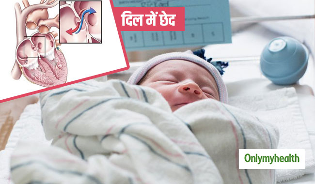 बच्चे के दिल में छेद के क्या हैं लक्षण और इलाज, बता रहे हैं एक्सपर्ट