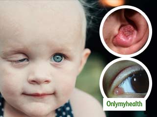 World Health Day 2020: मांसपेशियों का कैंसर है  रैबडोमायोसरकोमा, 20 से कम उम्र के बच्‍चों को करता है प्रभावित 